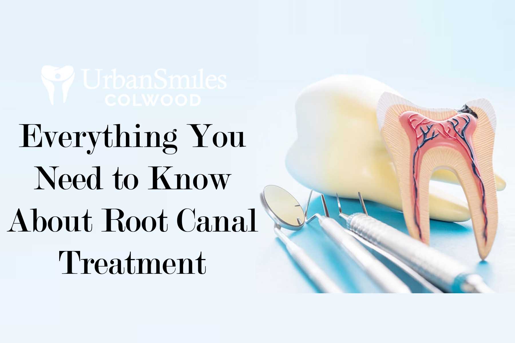 Everything You Need to Know About Root Canal Treatment